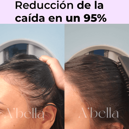 Dúo A’Bella: Sérum Anticaída & Crecimiento + Óleo Capilar Anti-Frizz